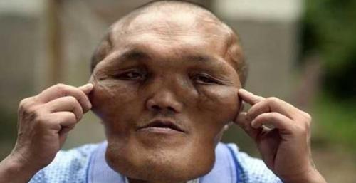 Kỳ dị ông lão có khuôn mặt của “người ngoài hành tinh”