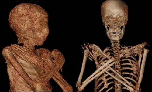 Lần đầu tiên phát hiện xác ướp Ai Cập cổ đại vẫn đang… mang thai