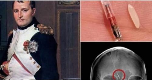 Vi mạch kỳ lạ được tìm thấy trong sọ Napoleon – người ngoài hành tinh?