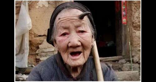 Bí ẩn những người mọc sừng – hiện tượng y học chưa thể lý giải?